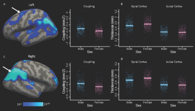 Brain scans with bar charts