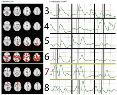 brain scans next to charts of brainwaves