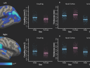 Brain scans with bar charts