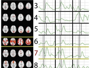 brain scans next to charts of brainwaves