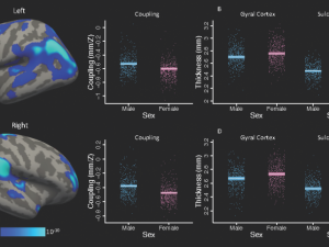 Brain scans with bar charts