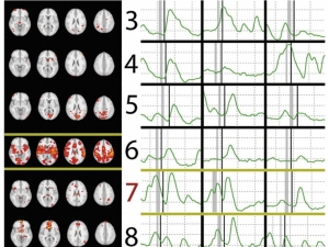 brain scans next to charts of brainwaves
