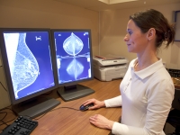 woman viewing mammogram results