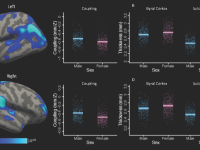 Brain scans with bar charts